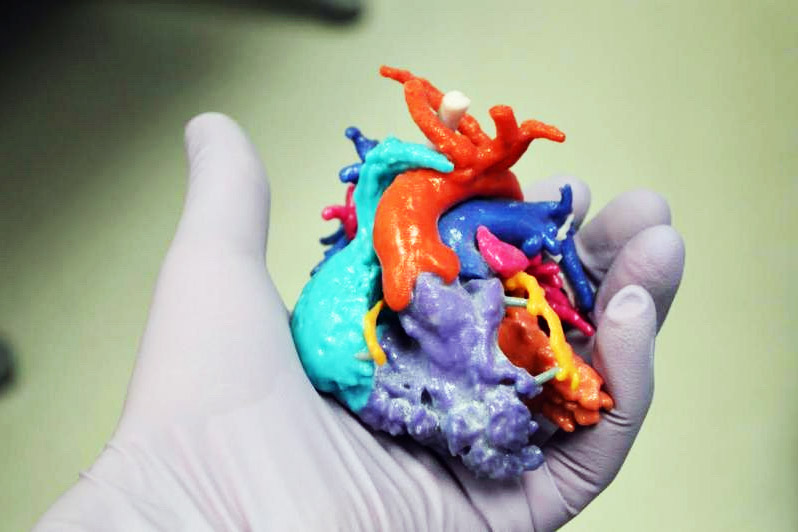 Additive Manufacturing for Medical Applications